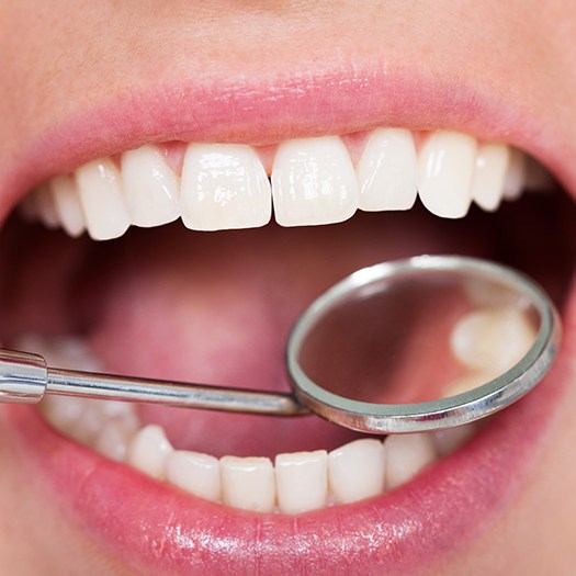 Dentist checking patients metal free dental crown