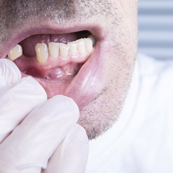 A close-up of a young man with missing teeth