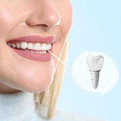 A closeup of a woman with a dental implant