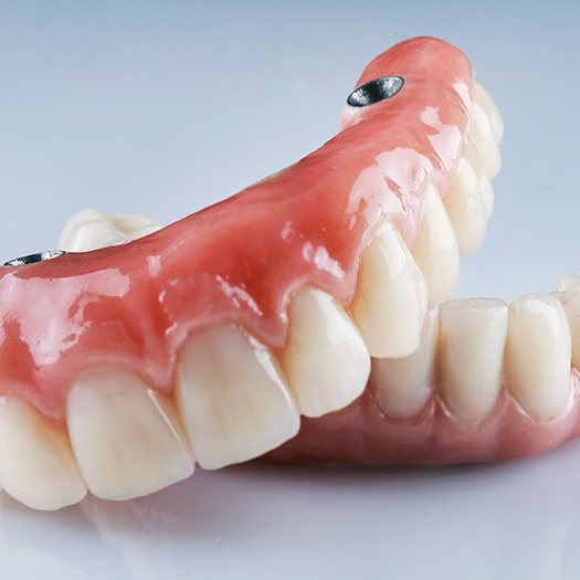 Implant dentures combine the convenience of dentures with the long-lasting capabilities of dental implants