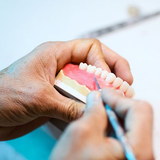 How dentures are made in Abingdon