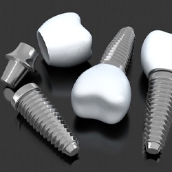 three dental implants with abutments and crowns