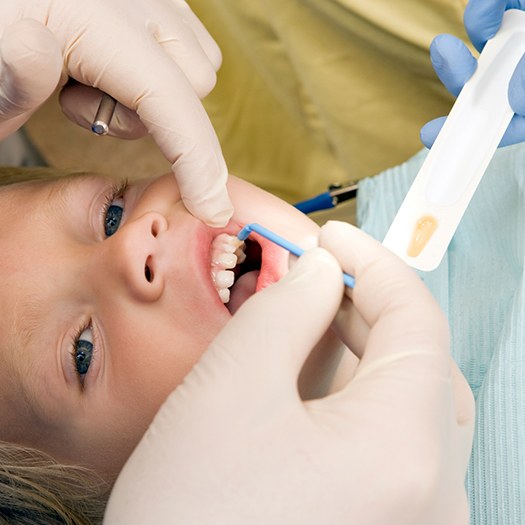 Young patient receiving fluoride treatment