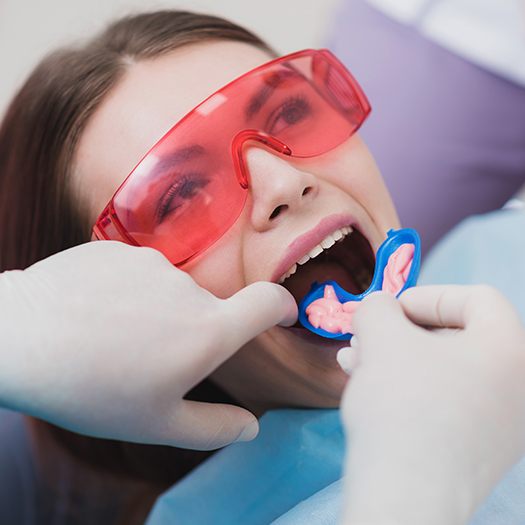 Young woman receiving fluoride treatment